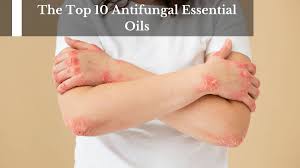 the top 10 antifungal essential oils