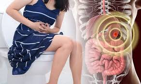 Symptoms of early stomach cancer can be similar to the symptoms of other conditions, such as stomach ulcers. Stomach Cancer Symptoms Blood In Your Poo Can Be A Sign Of The Disease Express Co Uk