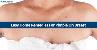 home remes for pimple on t