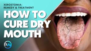 xerostomia dry mouth remedy