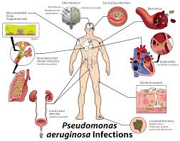 against pseudomonas aeruginosa infections