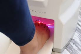 laser toenail fungus removal oregon