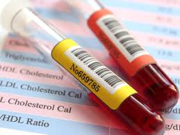 lipid profile test normal range what