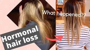 In a review of the relationship of hair loss to oral contraceptive (oc) use, several studies are examined. Hair Loss After Birth Control Day 1 Hair Growth Series How Do You Treat Hormonal Hair Loss Youtube