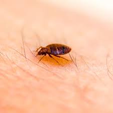 bed bug bites symptoms id treatment