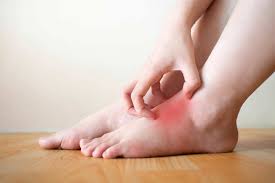 foot itch causes and treatment