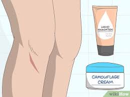 3 ways to hide scars on legs wikihow