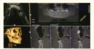 cone beam computed tomography cbct