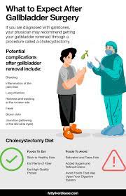 the cholecystectomy t