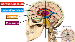 ventricles of the brain labeled