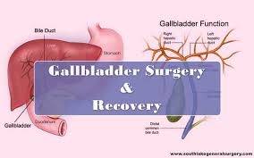 gallbladder removal surgery