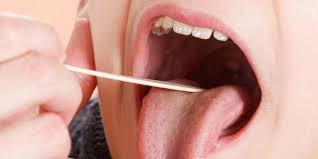 Die mundfäule ist eine erkrankung, die vor allem die schleimhaut des rachens und des mundes betrifft. Mundfaule