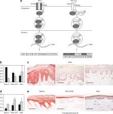 Effective Treatment Of Psoriasis With Narrow Band Uvb Phototherapy Is Linked To Suppression Of The Ifn And Th17 Pathways Sciencedirect