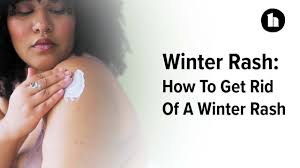 winter rash healthline