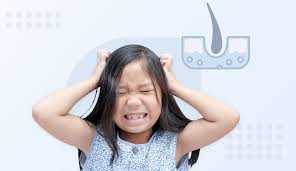 head lice view causes symptoms and