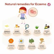 natural remes for eczema treatment