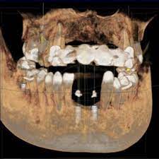 dental cone beam computedtomography