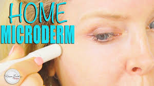 how to do microdermabrasion at home diy