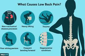 back pain causes treatment and when