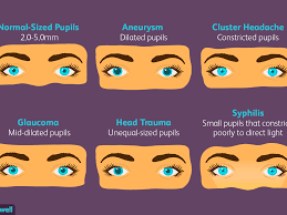 Pupil Size And Your Health