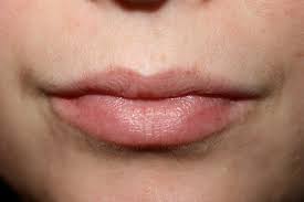 dealing with new freckles on your lips