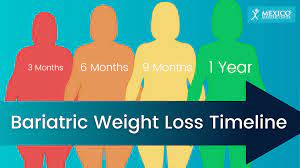 bariatric surgery weight loss calculator