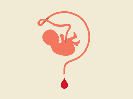 is cord blood banking worth it the