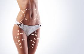 liposuction recovery a week by week