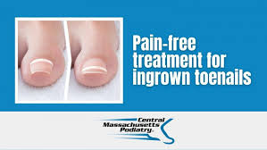 treatment for ingrown toenails