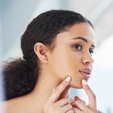 Check spelling or type a new query. How To Get Rid Of Pimples Fast Quick Ways To Eliminate Zits Acne