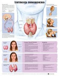 Anatomical Chart Thyroid Disorders