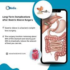 complications after gastric sleeve surgery