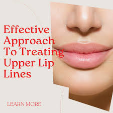 upper lip lines