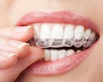 Image result for What is  Teeth Whitening