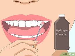 To treat your tooth pain, a dentist will first review your medical history and conduct an exam. 3 Ways To Cure A Toothache Wikihow