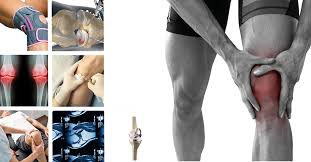 8 ways to be rid of knee pain in the