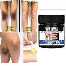Dark Knees And Elbows Lightening Cream Dark Spots Cream Ebay