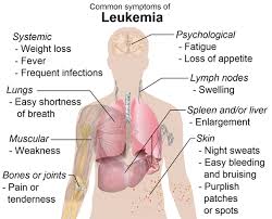 Difference Between Acute And Chronic Leukemia Difference