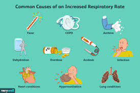 normal respiratory rate for s and