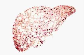 fish oil for fatty liver and optimal