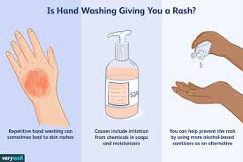 hand rashes due to handwashing 5