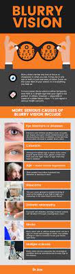 blurry vision causes 5 natural ways