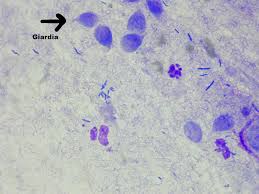 have questions about giardia cascade