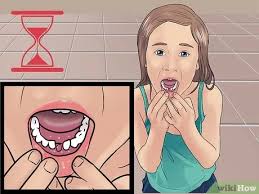 Sometimes, if the tooth is really loose, i will tie a piece of floss around it. How To Stop The Bleeding After You Pull Out A Loose Tooth