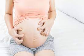 treat itchy bellies during pregnancy