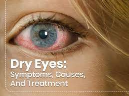 dry eyes symptoms causes risk