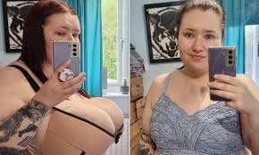 Woman rejected for NHS breast reduction surgery goes down 21 cup sizes  raising £8K for private op | Daily Mail Online