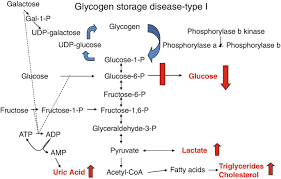 glycogen storage diseases springerlink