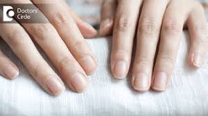 causes of nails turning white partially