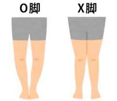 O脚、X脚の原因】は運動不足と歪みが原因だった！？マスターストレッチで美脚になるため３つの裏技！